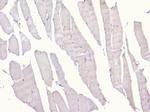 PCDH15 Antibody in Immunohistochemistry (Paraffin) (IHC (P))