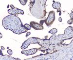 PKC beta-1 Antibody in Immunohistochemistry (Paraffin) (IHC (P))