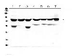 PKC beta-1 Antibody in Western Blot (WB)