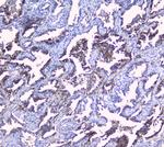 Sorcin Antibody in Immunohistochemistry (Paraffin) (IHC (P))