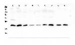 Sorcin Antibody in Western Blot (WB)