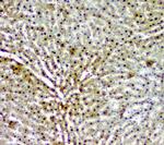 AKR1D1 Antibody in Immunohistochemistry (Paraffin) (IHC (P))