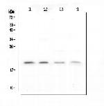 APRT Antibody in Western Blot (WB)