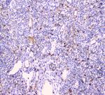 CDA Antibody in Immunohistochemistry (Paraffin) (IHC (P))