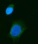 CHM Antibody in Immunocytochemistry (ICC/IF)