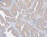 IQGAP1 Antibody in Immunohistochemistry (Paraffin) (IHC (P))