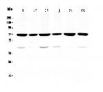 KBTBD2 Antibody in Western Blot (WB)