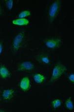 TIM17 Antibody in Immunocytochemistry (ICC/IF)