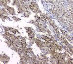 TIM17 Antibody in Immunohistochemistry (Paraffin) (IHC (P))