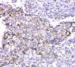 TIM17 Antibody in Immunohistochemistry (Paraffin) (IHC (P))