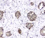 TIM17 Antibody in Immunohistochemistry (Paraffin) (IHC (P))