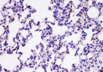 TIM17 Antibody in Immunohistochemistry (Paraffin) (IHC (P))