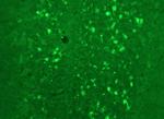 Calretinin Antibody in Immunohistochemistry (IHC)