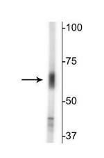 SLC6A13 Antibody in Western Blot (WB)