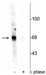 Phospho-AKT1 (Thr342) Antibody in Western Blot (WB)