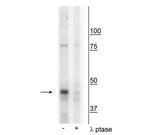 Phospho-Creatine Kinase MT (Tyr153) Antibody in Western Blot (WB)