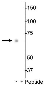 Phospho-p70 S6 Kinase (Ser398) Antibody in Western Blot (WB)