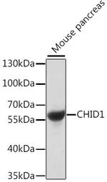 SI-CLP Antibody in Western Blot (WB)