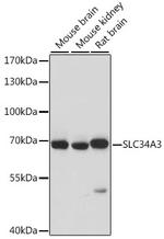 SLC34A3 Antibody in Western Blot (WB)