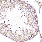 CD62L Antibody in Immunohistochemistry (Paraffin) (IHC (P))