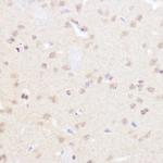 BRD2 Antibody in Immunohistochemistry (Paraffin) (IHC (P))