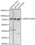 ASM Antibody in Western Blot (WB)