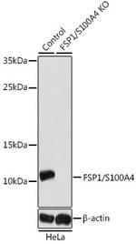 S100A4 Antibody