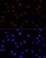 UNC84B Antibody in Immunocytochemistry (ICC/IF)