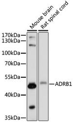 beta-1 Adrenergic Receptor Antibody in Western Blot (WB)