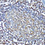 CXCR1 Antibody in Immunohistochemistry (Paraffin) (IHC (P))