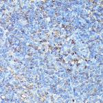 CXCR1 Antibody in Immunohistochemistry (Paraffin) (IHC (P))