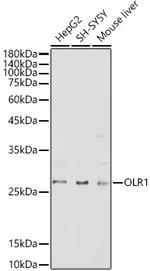 LOX-1 Antibody in Western Blot (WB)