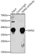 SMN Antibody in Immunoprecipitation (IP)