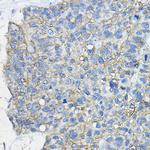 CD46 Antibody in Immunohistochemistry (Paraffin) (IHC (P))