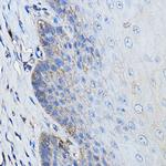 CD46 Antibody in Immunohistochemistry (Paraffin) (IHC (P))