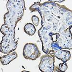 CD46 Antibody in Immunohistochemistry (Paraffin) (IHC (P))