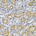 GRK2 Antibody in Immunohistochemistry (Paraffin) (IHC (P))