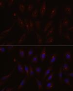 PCM1 Antibody in Immunocytochemistry (ICC/IF)