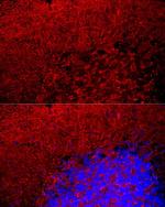 MBP Antibody in Immunocytochemistry (ICC/IF)