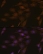 PYCARD Antibody in Immunocytochemistry (ICC/IF)