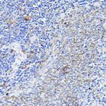 NOTCH1 Antibody in Immunohistochemistry (Paraffin) (IHC (P))