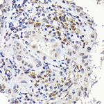 NOTCH1 Antibody in Immunohistochemistry (Paraffin) (IHC (P))