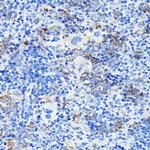 NOTCH1 Antibody in Immunohistochemistry (Paraffin) (IHC (P))