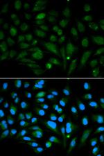 Decorin Antibody in Immunocytochemistry (ICC/IF)