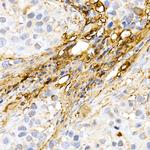 Decorin Antibody in Immunohistochemistry (Paraffin) (IHC (P))