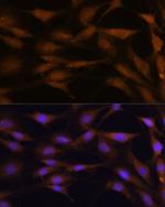 TFAP4 Antibody in Immunocytochemistry (ICC/IF)