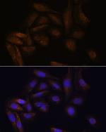 TFAP4 Antibody in Immunocytochemistry (ICC/IF)