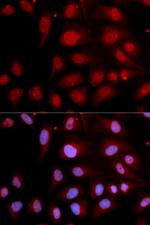 POLB Antibody in Immunocytochemistry (ICC/IF)