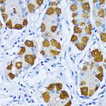 POLB Antibody in Immunohistochemistry (Paraffin) (IHC (P))