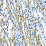 POLB Antibody in Immunohistochemistry (Paraffin) (IHC (P))